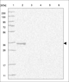 Anti-ACBD6 Antibody