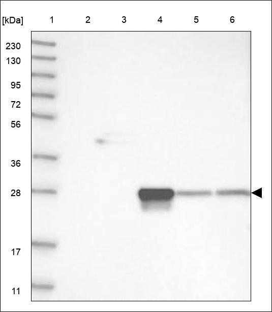 Anti-KRTAP10-8 Antibody