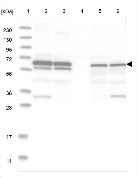Anti-AMFR Antibody