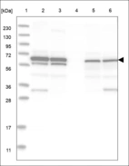 Anti-AMFR Antibody