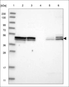 Anti-ACTRT1 Antibody