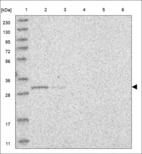 Anti-TSSK6 Antibody