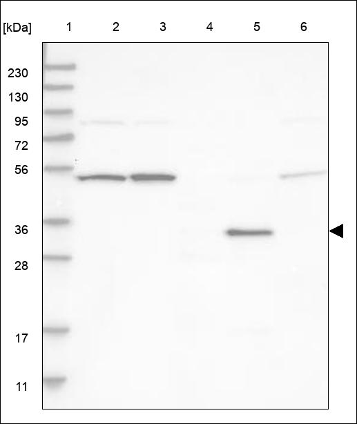 Anti-FGL1 Antibody