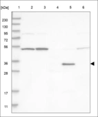 Anti-FGL1 Antibody