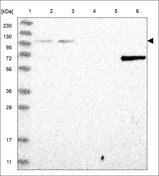 Anti-NUP107 Antibody
