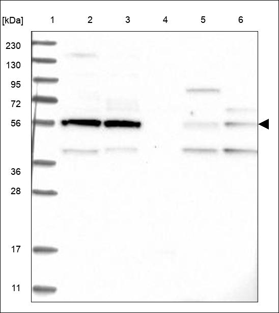 Anti-SOCS5 Antibody