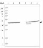 Anti-CXCR1 Antibody