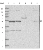 Anti-SOCS6 Antibody