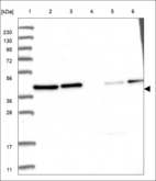 Anti-PURA Antibody