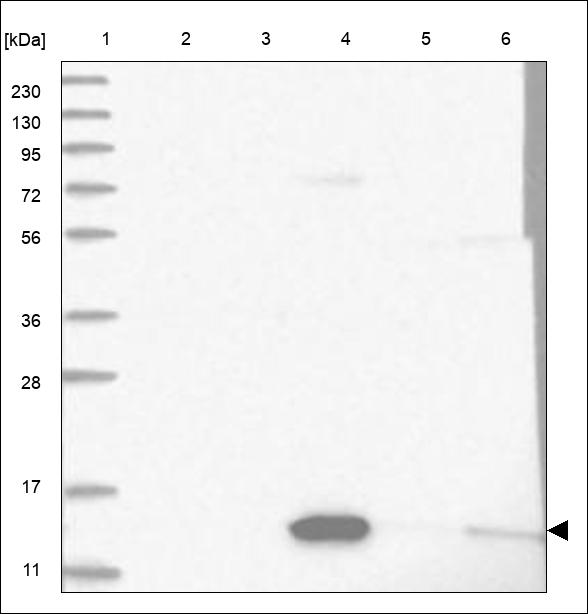 Anti-ANG Antibody