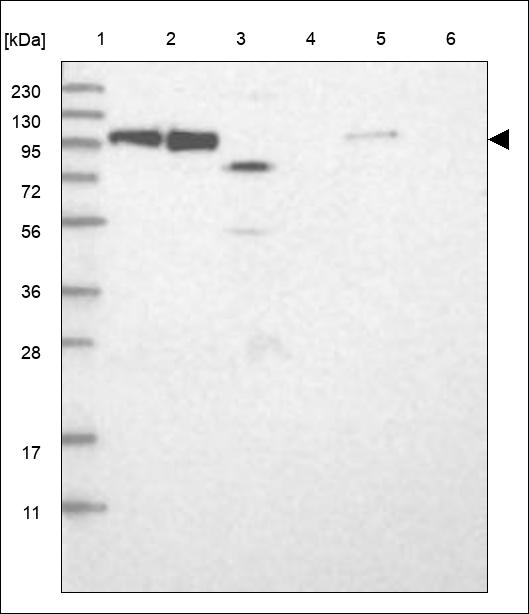 Anti-AGGF1 Antibody