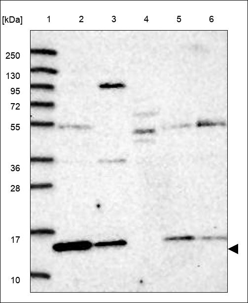 Anti-TIMM10B Antibody