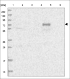 Anti-OIT3 Antibody