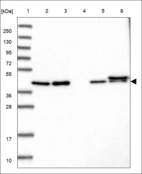 Anti-FOXA2 Antibody
