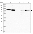 Anti-TUT1 Antibody