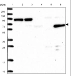 Anti-TDRD3 Antibody