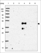 Anti-ANKDD1B Antibody