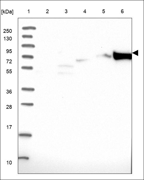 Anti-FHIP1B Antibody