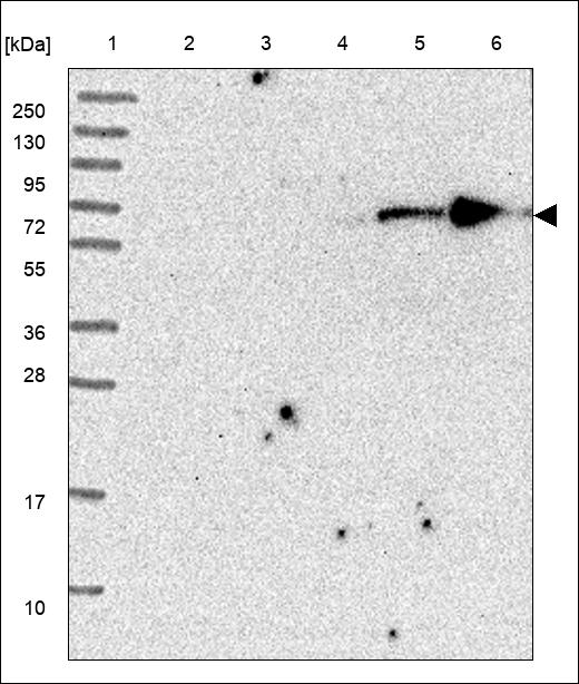 Anti-KLHL23 Antibody