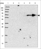 Anti-KLHL23 Antibody