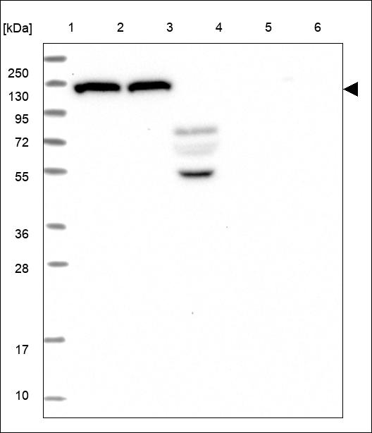 Anti-ADCY6 Antibody