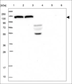 Anti-ADCY6 Antibody