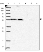 Anti-PIF1 Antibody