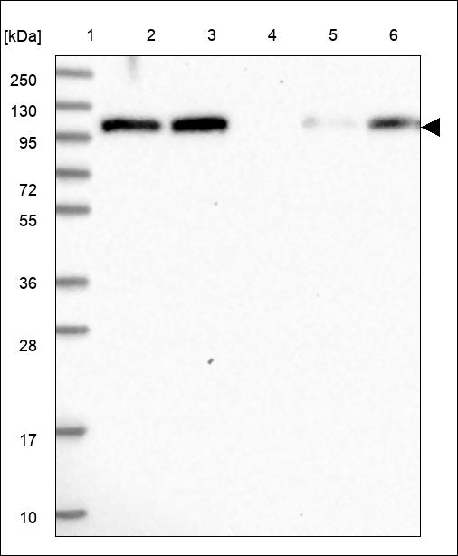 Anti-FHIP2A Antibody