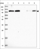 Anti-FHIP2A Antibody