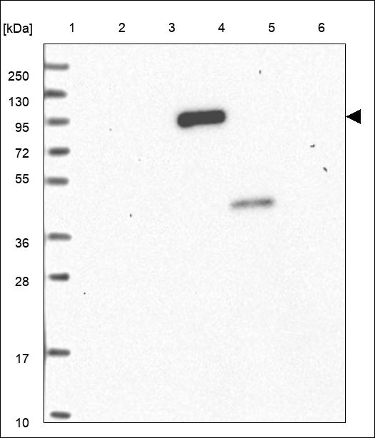 Anti-STK31 Antibody