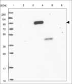 Anti-STK31 Antibody