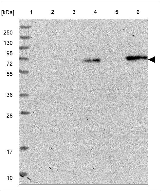 Anti-SEMA3D Antibody