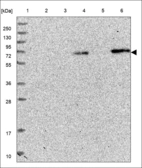 Anti-SEMA3D Antibody