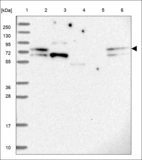 Anti-ZNF417 Antibody