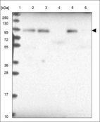 Anti-SH2B1 Antibody
