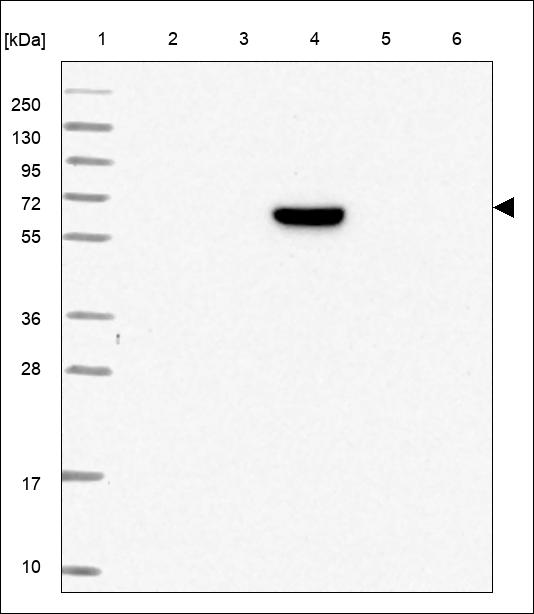 Anti-FSCN3 Antibody