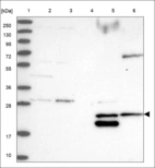 Anti-DMAC2 Antibody