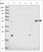 Anti-MAB21L4 Antibody