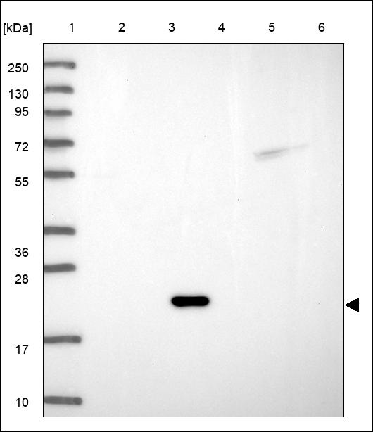 Anti-JDP2 Antibody