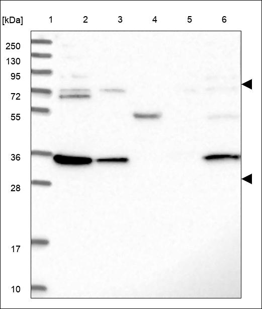 Anti-UVSSA Antibody