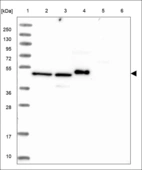 Anti-NOB1 Antibody