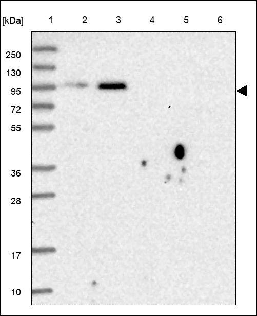 Anti-UBA2 Antibody