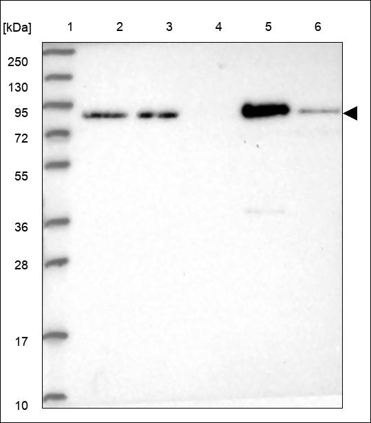 Anti-EPN1 Antibody