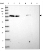 Anti-PMS2 Antibody