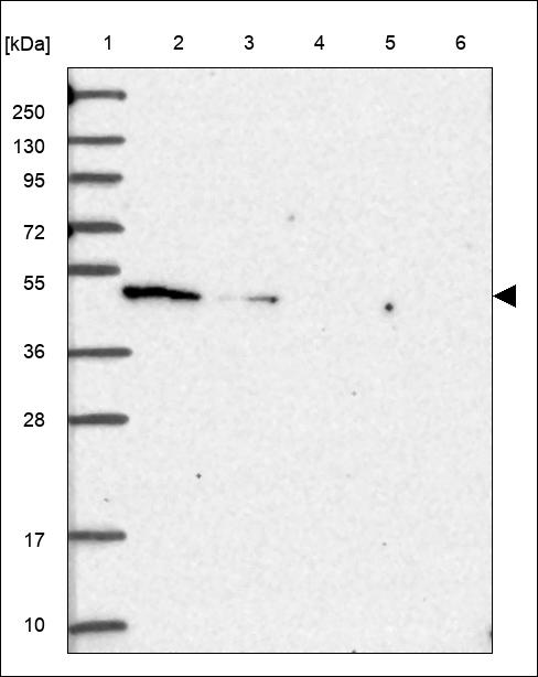 Anti-ANKRD42 Antibody