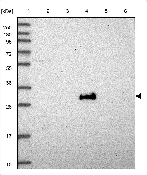 Anti-DHRS12 Antibody
