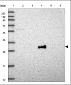 Anti-DHRS12 Antibody