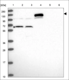 Anti-RASGRF1 Antibody