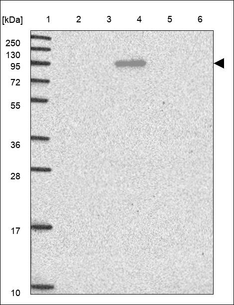 Anti-CATSPER1 Antibody