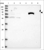 Anti-THNSL1 Antibody